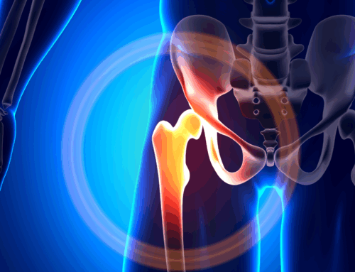 Iliopsoas Muscle Syndrome: A Hidden Culprit in Back and Hip Discomfort
